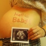 妊婦さんのお腹とエコー写真